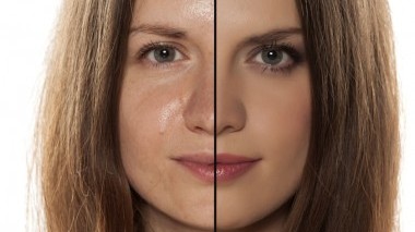 Come togliere l'effetto lucido dal viso? Guida completa per una pelle opacizzata e luminosa